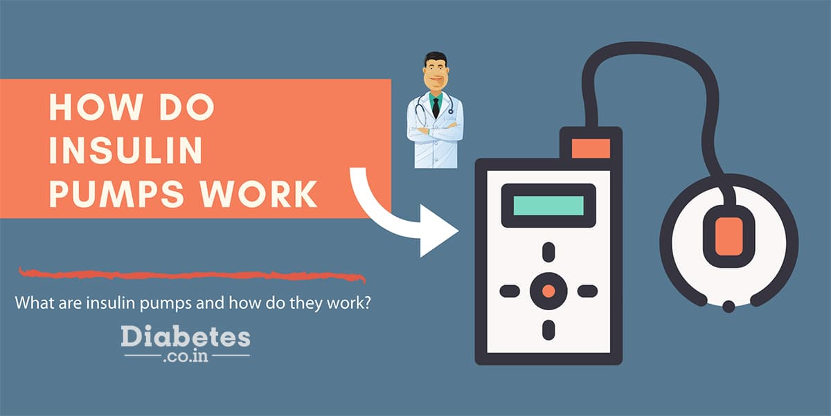 How do Insulin Pumps Work?