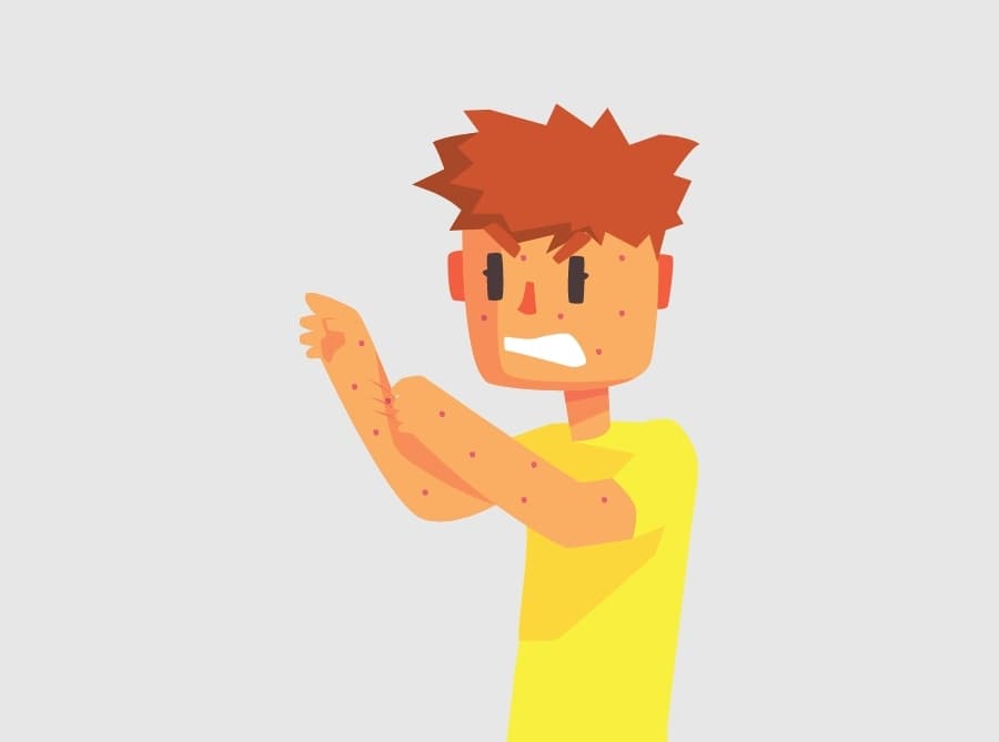 Is Itching a Symptom of Diabetes?