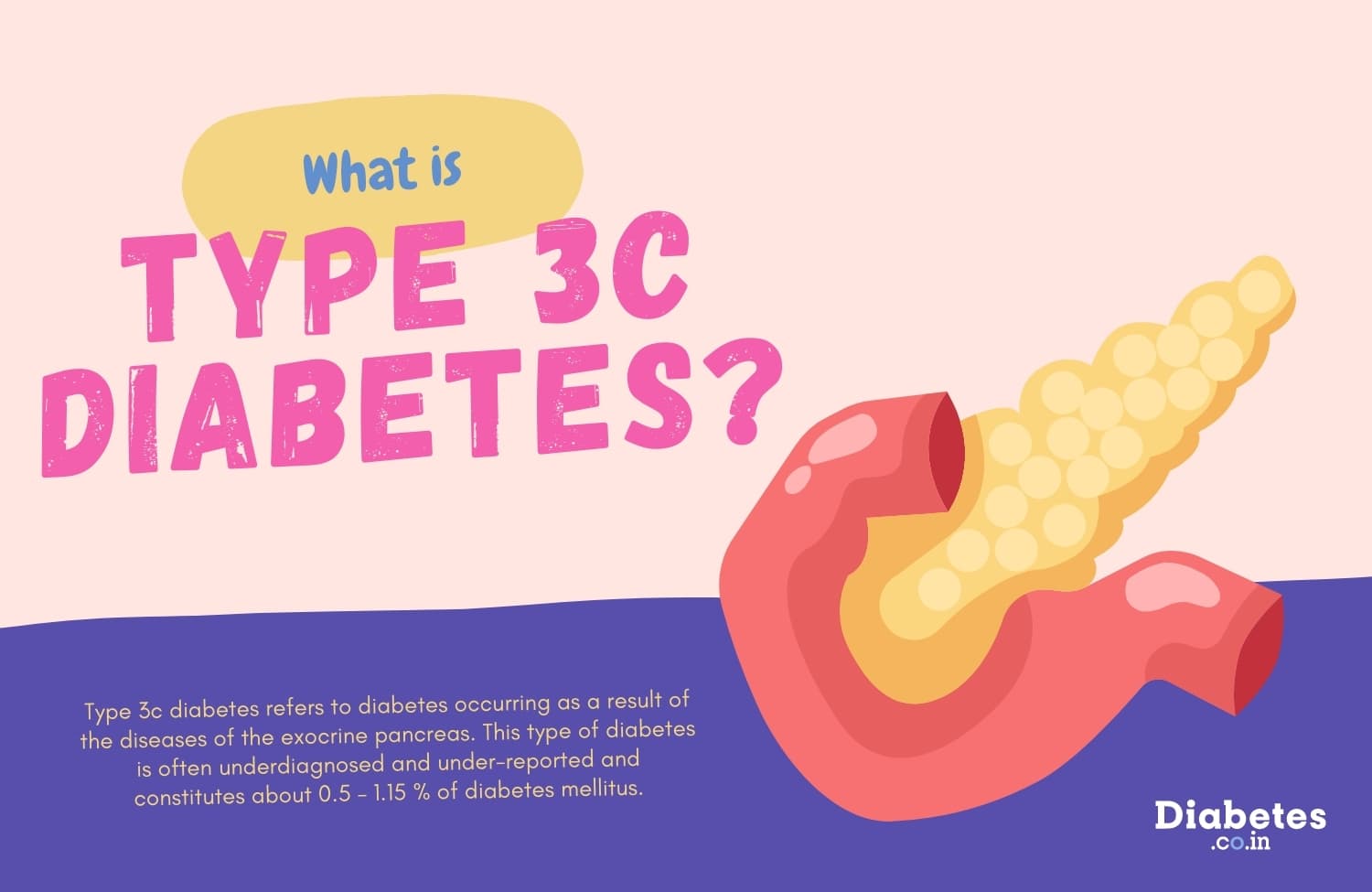 What is Type 3c Diabetes?