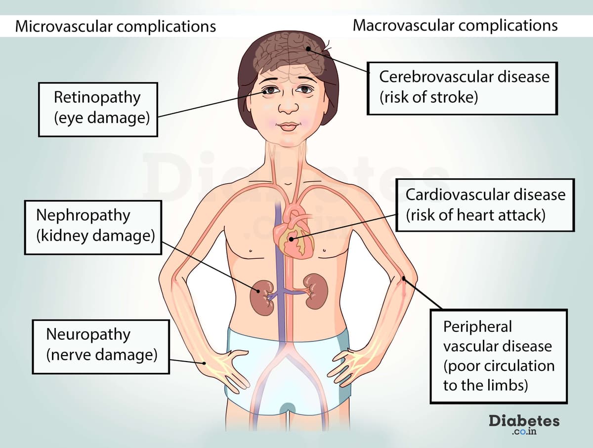 What are the Long term Complications of Diabetes?