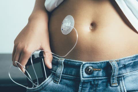 Who should use an Insulin Pump and What are the Disadvantages?