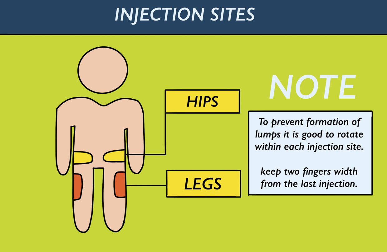 insulin injection sites